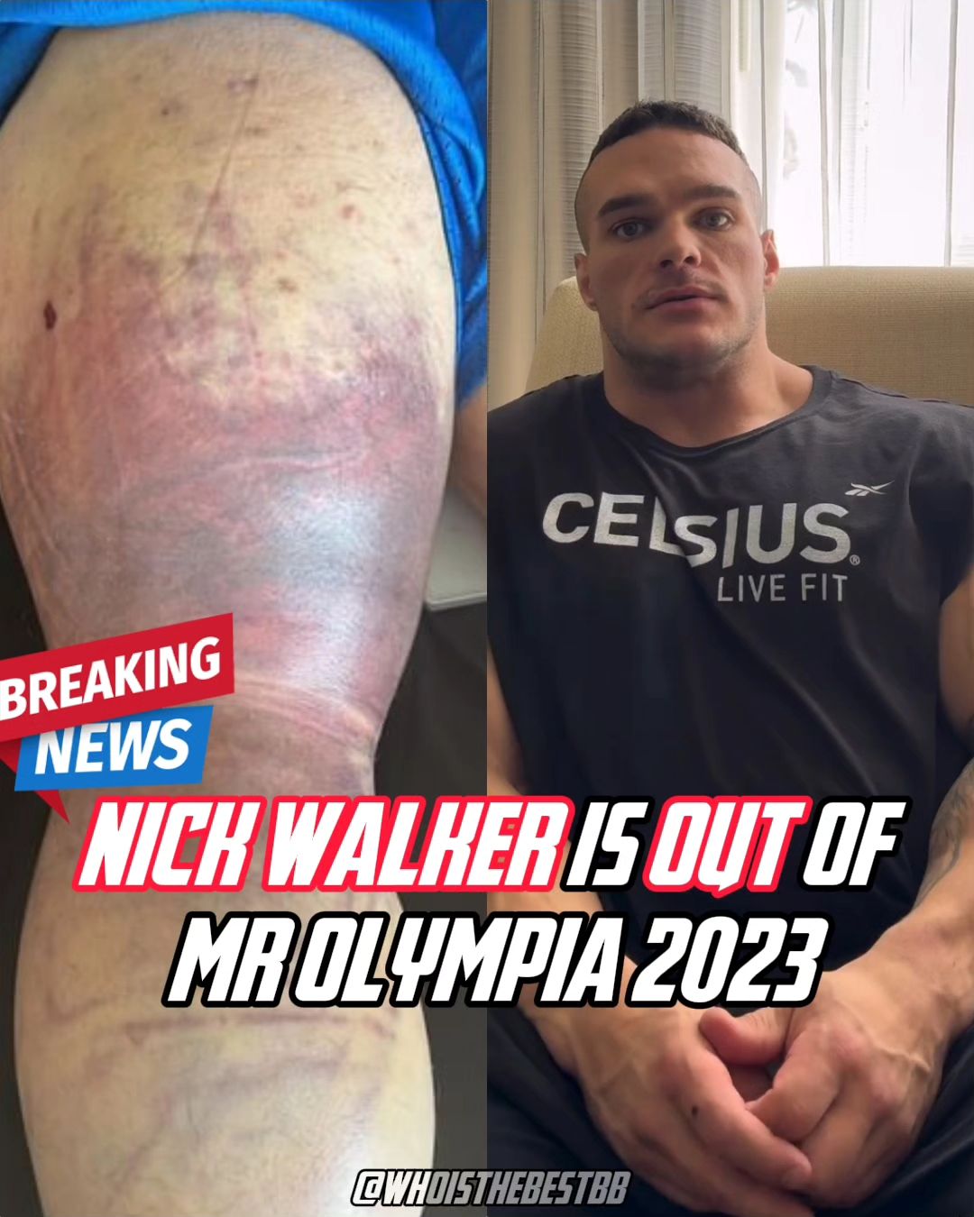 Nick Walker zranění 